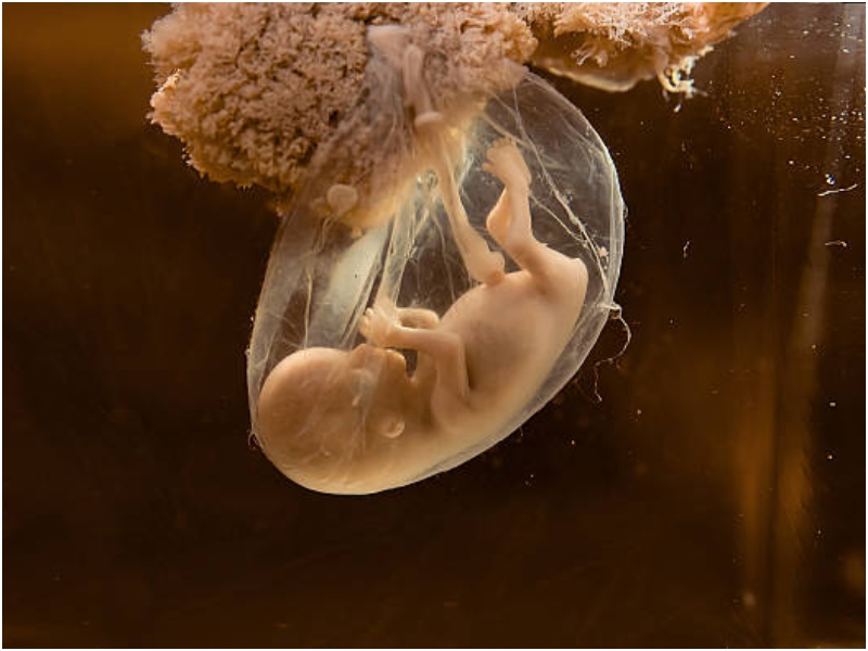 Alabama Supreme Court’s Frozen Embryo Ruling: 5 Shocking Implications Uncovered