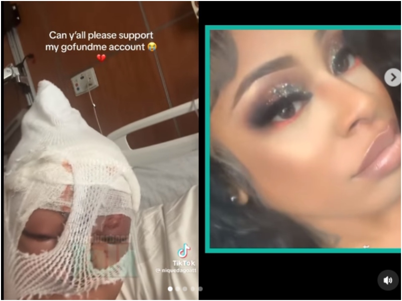 Woman Seeks Support for Reconstructive Surgery After Sister Threw Acid On Her! These Are Her Legal Options
