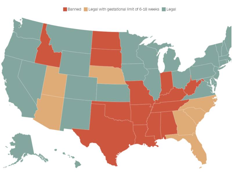 Check Out Which States Have Banned Abortion, Where It’s Legal and Where It’s Still In Limbo