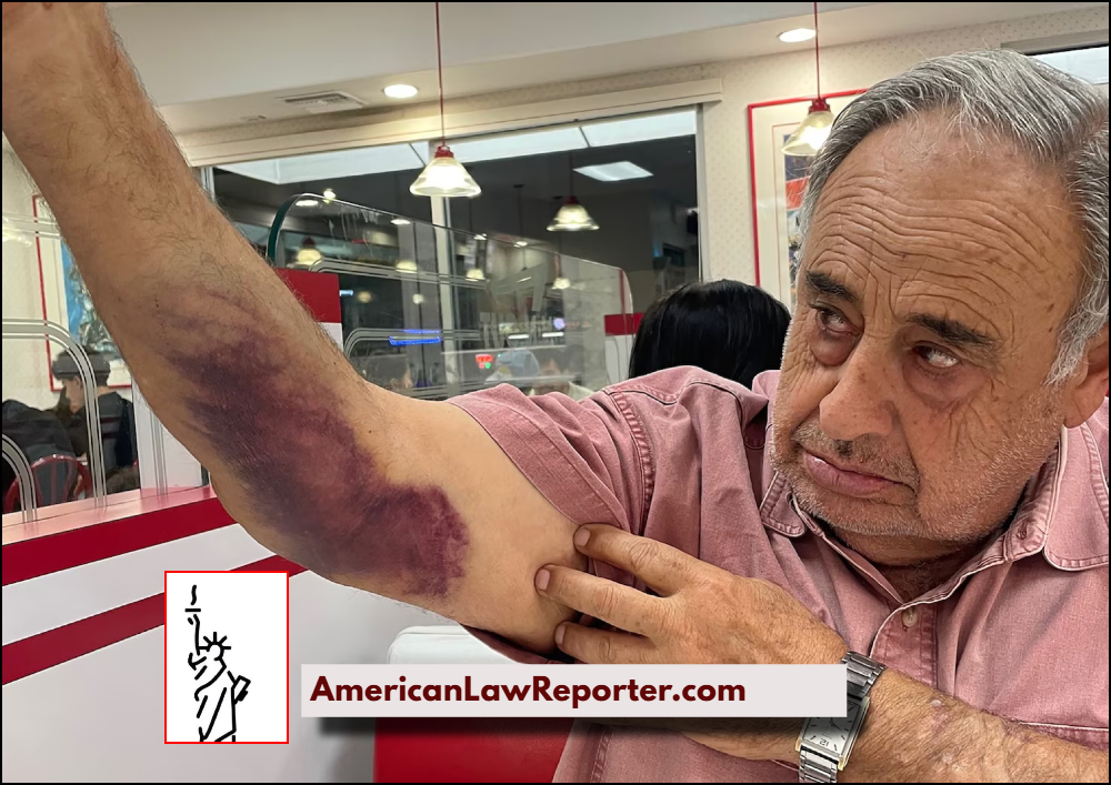 79-Year-Old U.S. Citizen Sues ICE for $50M Over Alleged Body-Slamming at His Car Wash