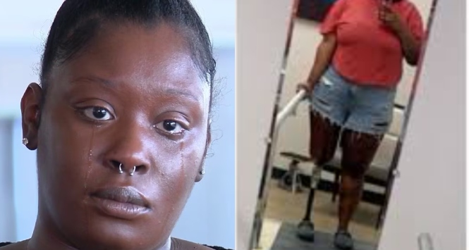 Maryland Jury Awards $18 Million in Amputation Case, With Statutory Cap Likely to Reduce Damages